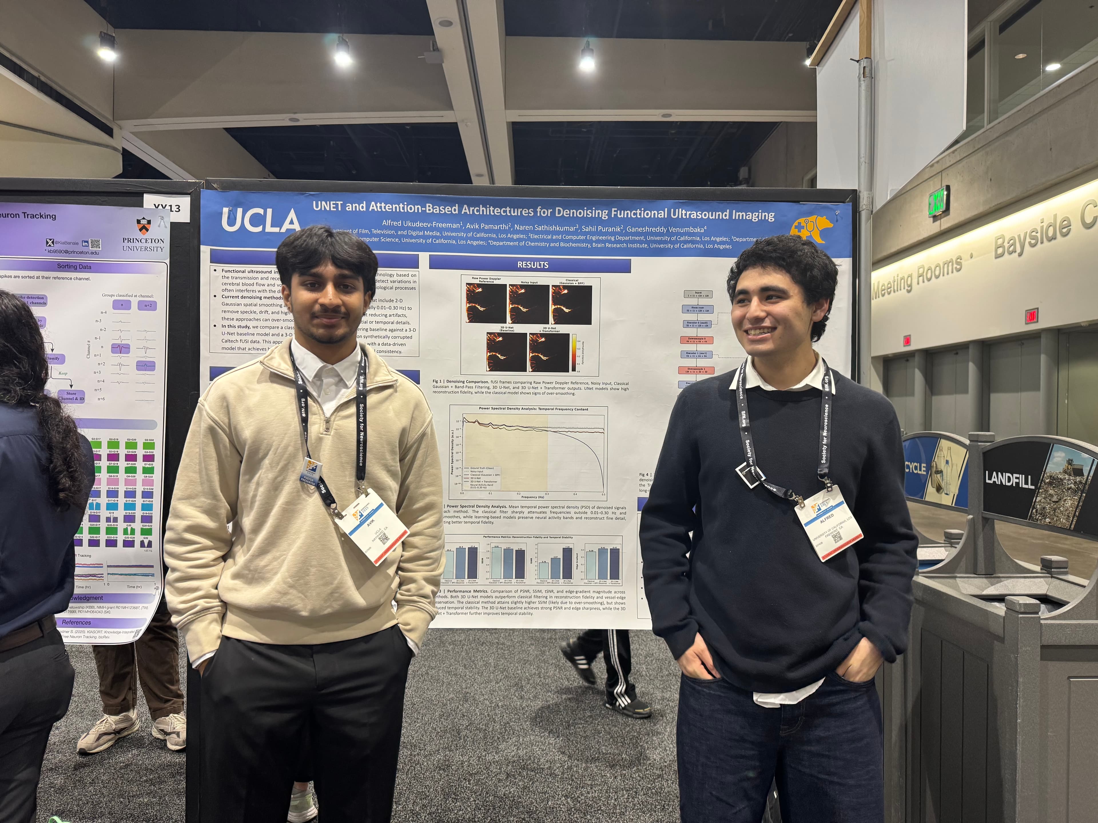 Functional ultrasound imaging research, sample 2